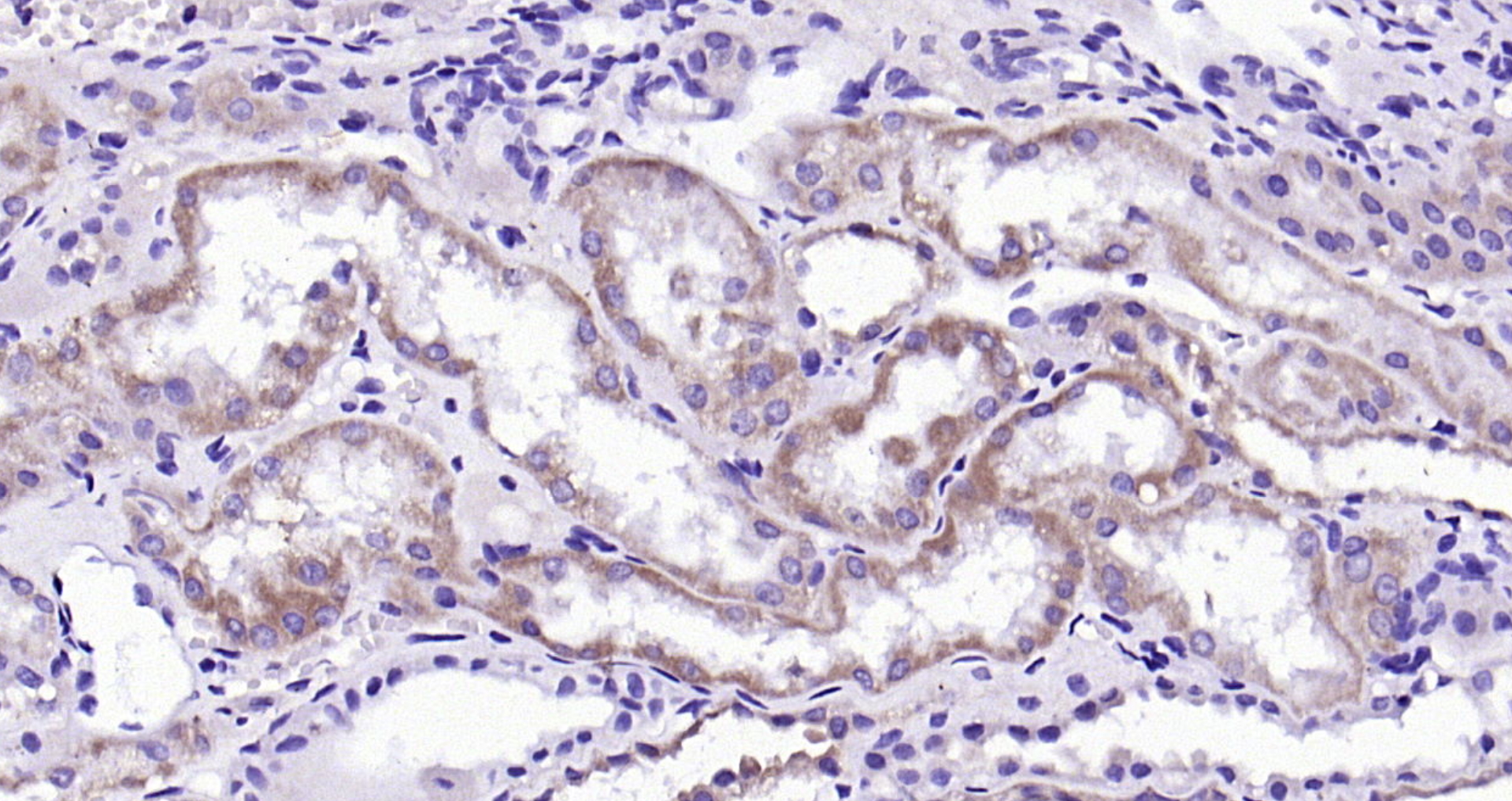 Paraformaldehyde-fixed, paraffin embedded (Human kidney); Antigen retrieval by boiling in sodium citrate buffer (pH6.0) for 15min; Block endogenous peroxidase by 3% hydrogen peroxide for 20 minutes; Blocking buffer (normal goat serum) at 37°C for 30min; Antibody incubation with (Granulin) Polyclonal Antibody, Unconjugated (bs-0823R) at 1:200 overnight at 4°C, followed by operating according to SP Kit(Rabbit) (sp-0023) instructionsand DAB staining.