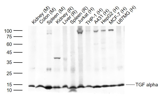 Lane 1: Mouse Kidney tissue lysates; Lane 2: Mouse Colon tissue lysates; Lane 3: Mouse Spleen tissue lysates; Lane 4: Rat Kidney tissue lysates; Lane 5: Rat Liver tissue lysates; Lane 6: Rat Spleen tissue lysates; Lane 7: Human Jurkat cell lysates; Lane 8: Human THP-1 cell lysates; Lane 9: Human A431 cell lysates; Lane 10: Human HepG2 cell lysates; Lane 11: Human MCF-7 cell lysates; Lane 12: Human U87MG cell lysates probed with TGF alpha Polyclonal Antibody, Unconjugated (bs-0066R) at 1:1000 dilution and 4°C overnight incubation. Followed by conjugated secondary antibody incubation at 1:20000 for 60 min at 37˚C.