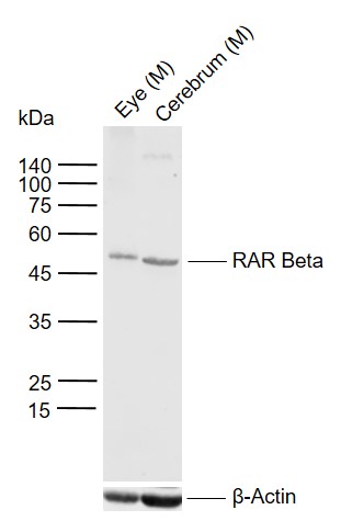 Lane 1: Mouse Eye tissue lysates; Lane 2: Mouse Cerebrum tissue lysates probed with RAR Beta Polyclonal Antibody, Unconjugated (bs-0516R) at 1:1000 dilution and 4\u00b0C overnight incubation. Followed by conjugated secondary antibody incubation at 1:20000 for 60 min at 37˚C.
