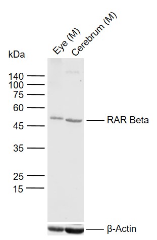 Lane 1: Mouse Eye tissue lysates; Lane 2: Mouse Cerebrum tissue lysates probed with RAR Beta Polyclonal Antibody, Unconjugated (bs-0516R) at 1:1000 dilution and 4°C overnight incubation. Followed by conjugated secondary antibody incubation at 1:20000 for 60 min at 37˚C.