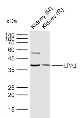 Lane 1: Mouse Kidney tissue lysates; Lane 2: Rat Kidney tissue lysates probed with LPA1/LPAR1 Polyclonal Antibody, Unconjugated (bs-2880R) at 1:1000 dilution and 4°C overnight incubation. Followed by conjugated secondary antibody incubation at 1:20000 for 60 min at 37˚C.