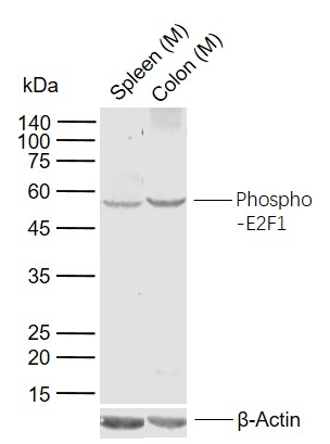 Lane 1: Mouse Spleen tissue lysates; Lane 2: Mouse Colon tissue lysates probed with phospho-E2F1 (Ser337) Polyclonal Antibody, Unconjugated (bs-5305R) at 1:1000 dilution and 4°C overnight incubation. Followed by conjugated secondary antibody incubation at 1:20000 for 60 min at 37˚C.