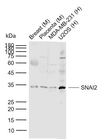 Lane 1: Mouse Breast tissue lysates; Lane 2: Mouse Placenta tissue lysates; Lane 3: Human MDA-MB-231 cell lysates; Lane 4: Human U2OS cell lysates probed with SNAI2/SLUG Polyclonal Antibody, Unconjugated (bs-1382R) at 1:1000 dilution and 4°C overnight incubation. Followed by conjugated secondary antibody incubation at 1:20000 for 60 min at 37˚C.