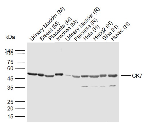 Lane 1: Mouse Urinary bladder tissue lysates; Lane 2: Mouse Breast tissue lysates; Lane 3: Mouse Placenta tissue lysates; Lane 4: Mouse trachea tissue lysates; Lane 5: Rat Urinary bladder tissue lysates; Lane 6: Rat Placenta tissue lysates; Lane 7: Human Hela cell lysates; Lane 8: Human HepG2 cell lysates; Lane 9: Human Siha cell lysates; Lane 10: Human Huvec cell lysates probed with CK7 Polyclonal Antibody, Unconjugated (bs-1744R) at 1:1000 dilution and 4°C overnight incubation. Followed by conjugated secondary antibody incubation at 1:20000 for 60 min at 37˚C.