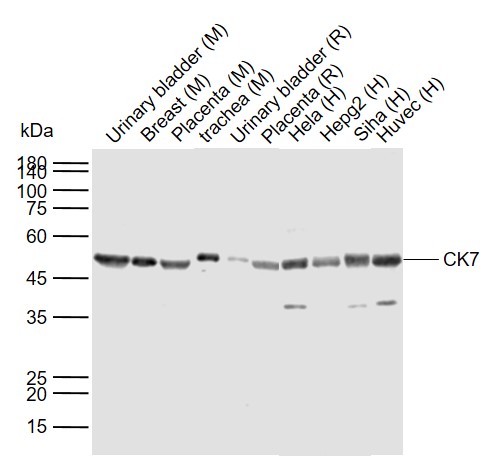 Lane 1: Mouse Urinary bladder tissue lysates; Lane 2: Mouse Breast tissue lysates; Lane 3: Mouse Placenta tissue lysates; Lane 4: Mouse trachea tissue lysates; Lane 5: Rat Urinary bladder tissue lysates; Lane 6: Rat Placenta tissue lysates; Lane 7: Human Hela cell lysates; Lane 8: Human HepG2 cell lysates; Lane 9: Human Siha cell lysates; Lane 10: Human Huvec cell lysates probed with CK7 Polyclonal Antibody, Unconjugated (bs-1610R) at 1:1000 dilution and 4°C overnight incubation. Followed by conjugated secondary antibody incubation at 1:20000 for 60 min at 37˚C.