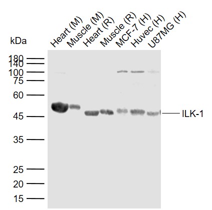 Lane 1: Mouse Heart tissue lysates; Lane 2: Mouse Muscle tissue lysates; Lane 3: Rat Heart tissue lysates; Lane 4: Rat Muscle tissue lysates; Lane 5: Human MCF-7 cell lysates; Lane 6: Human Huvec cell lysates; Lane 7: Human U87MG cell lysates probed with ILK-1 Polyclonal Antibody, Unconjugated (bs-0317R) at 1:1000 dilution and 4°C overnight incubation. Followed by conjugated secondary antibody incubation at 1:20000 for 60 min at 37˚C.