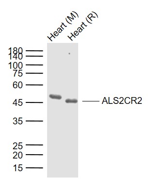 Lane 1: Mouse Heart tissue lysates; Lane 2: Rat Heart tissue lysates probed with ALS2CR2 Polyclonal Antibody, Unconjugated (bs-3928R) at 1:1000 dilution and 4°C overnight incubation. Followed by conjugated secondary antibody incubation at 1:20000 for 60 min at 37˚C.