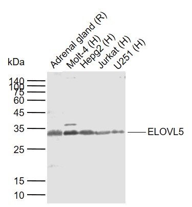 Lane 1: Rat Adrenal gland tissue lysates; Lane 2: Human Molt-4 cell lysates; Lane 3: Human HepG2 cell lysates; Lane 4: Human Jurkat cell lysates; Lane 5: Human U251 cell lysates probed with ELOVL5 Polyclonal Antibody, Unconjugated (bs-7054R) at 1:1000 dilution and 4°C overnight incubation. Followed by conjugated secondary antibody incubation at 1:20000 for 60 min at 37˚C.