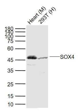 Lane 1: Mouse Heart tissue lysates; Lane 2: Human 293T cell lysates probed with SOX4 Polyclonal Antibody, Unconjugated (bs-11208R) at 1:1000 dilution and 4°C overnight incubation. Followed by conjugated secondary antibody incubation at 1:20000 for 60 min at 37˚C.