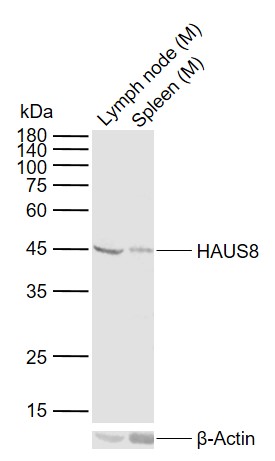 Lane 1: Mouse Lymph node tissue lysates; Lane 2: Mouse Spleen tissue lysates probed with HAUS8/NYS48 Polyclonal Antibody, Unconjugated (bs-9320R) at 1:1000 dilution and 4°C overnight incubation. Followed by conjugated secondary antibody incubation at 1:20000 for 60 min at 37˚C.