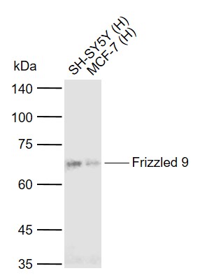 Lane 1: Human SH-SY5Y cell lysates; Lane 2: Human MCF-7 cell lysates probed with Frizzled 9 Polyclonal Antibody, Unconjugated (bs-11842R) at 1:1000 dilution and 4°C overnight incubation. Followed by conjugated secondary antibody incubation at 1:20000 for 60 min at 37˚C.