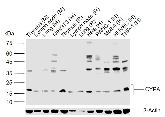 Lane 1: Mouse Thymus tissue lysates; Lane 2: Mouse Lymph node tissue lysates; Lane 3: Mouse Lung tissue lysates; Lane 4: Mouse NIH/3T3 cell lysates; Lane 5: Rat Thymus tissue lysates; Lane 6: Rat Lymph node tissue lysates; Lane 7: Rat Lung tissue lysates; Lane 8: Human Hela cell lysates; Lane 9: Human PANC-1 cell lysates; Lane 10: Human Molt-4 cell lysates; Lane 11: Human HUVEC cell lysates; Lane 12: Human THP-1 cell lysates probed with CYPA Polyclonal Antibody, Unconjugated (bs-5912R) at 1:1000 dilution and 4°C overnight incubation. Followed by conjugated secondary antibody incubation at 1:20000 for 60 min at 37˚C.