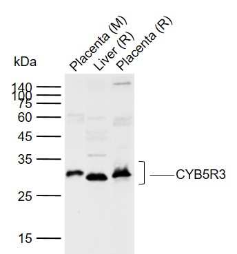 Lane 1: Mouse Placenta tissue lysates; Lane 2: Rat Liver tissue lysates; Lane 3: Rat Placenta tissue lysates probed with CYB5R3 Polyclonal Antibody, Unconjugated (bs-12162R) at 1:1000 dilution and 4°C overnight incubation. Followed by conjugated secondary antibody incubation at 1:20000 for 60 min at 37˚C. Lane 1: Mouse Placenta tissue lysates; Lane 2: Rat Liver tissue lysates; Lane 3: Rat Placenta tissue lysates probed with CYB5R3 Polyclonal Antibody, Unconjugated (bs-12162R) at 1:1000 dilution and 4°C overnight incubation. Followed by conjugated secondary antibody incubation at 1:20000 for 60 min at 37˚C.