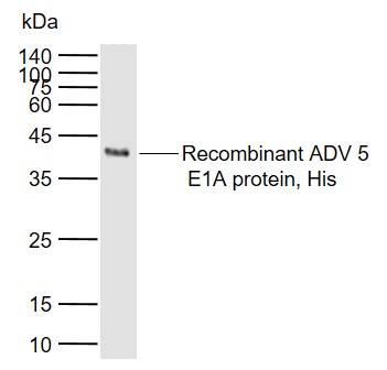 Lane 1: Recombinant ADV 5E1A protein, His probed with Adenovirus 5 E1A Polyclonal Antibody, Unconjugated (bs-6136R) at 1:1000 dilution and 4\u00b0C overnight incubation. Followed by conjugated secondary antibody incubation at 1:20000 for 60 min at 37˚C.