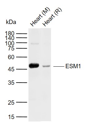Lane 1: Mouse Heart tissue lysates; Lane 2: Rat Heart tissue lysates probed with ESM1 Polyclonal Antibody, Unconjugated (bs-3615R) at 1:1000 dilution and 4°C overnight incubation. Followed by conjugated secondary antibody incubation at 1:20000 for 60 min at 37˚C.