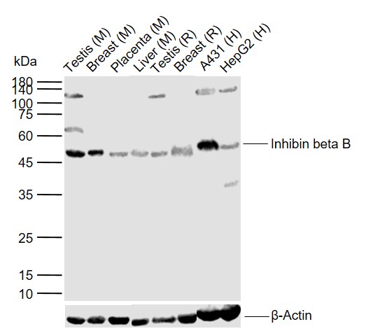 Lane 1: Mouse Testis tissue lysates; Lane 2: Mouse Breast tissue lysates; Lane 3: Mouse Placenta tissue lysates; Lane 4: Mouse Liver tissue lysates; Lane 5: Rat Testis tissue lysates; Lane 6: Rat Breast tissue lysates; Lane 7: Human A431 cell lysates; Lane 8: Human HepG2 cell lysates probed with Inhibin beta B Polyclonal Antibody, Unconjugated (bs-1825R) at 1:1000 dilution and 4°C overnight incubation. Followed by conjugated secondary antibody incubation at 1:20000 for 60 min at 37˚C.