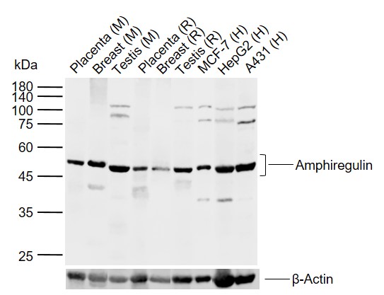 Lane 1: Mouse Placenta tissue lysates; Lane 2: Mouse Breast tissue lysates; Lane 3: Mouse Testis tissue lysates; Lane 4: Rat Placenta tissue lysates; Lane 5: Rat Breast tissue lysates; Lane 6: Rat Testis tissue lysates; Lane 7: Human MCF-7 cell lysates; Lane 8: Human HepG2 cell lysates; Lane 9: Human A431 cell lysates probed with Amphiregulin Polyclonal Antibody, Unconjugated (bs-3847R) at 1:1000 dilution and 4°C overnight incubation. Followed by conjugated secondary antibody incubation at 1:20000 for 60 min at 37˚C.