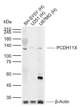 Lane 1: Human SH-SY5Y cell lysates; Lane 2: Human U251 cell lysates; Lane 3: Human U87MG cell lysates probed with PCDH11X Polyclonal Antibody, Unconjugated (bs-11107R) at 1:1000 dilution and 4°C overnight incubation. Followed by conjugated secondary antibody incubation at 1:20000 for 60 min at 37˚C.