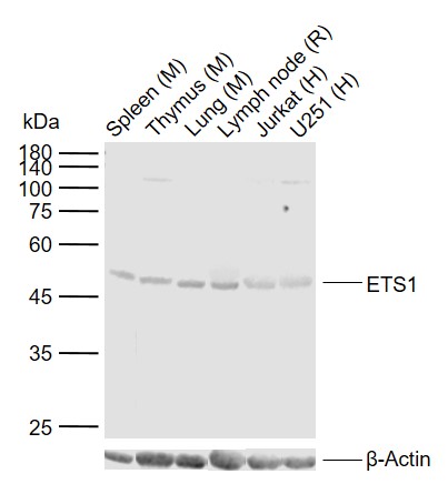 Lane 1: Mouse Spleen tissue lysates; Lane 2: Mouse Thymus tissue lysates; Lane 3: Mouse Lung tissue lysates; Lane 4: Rat Lymph node tissue lysates; Lane 5: Human Jurkat cell lysates; Lane 6: Human U251 cell lysates probed with ETS1 Polyclonal Antibody, Unconjugated (bs-1285R) at 1:1000 dilution and 4°C overnight incubation. Followed by conjugated secondary antibody incubation at 1:20000 for 60 min at 37˚C.