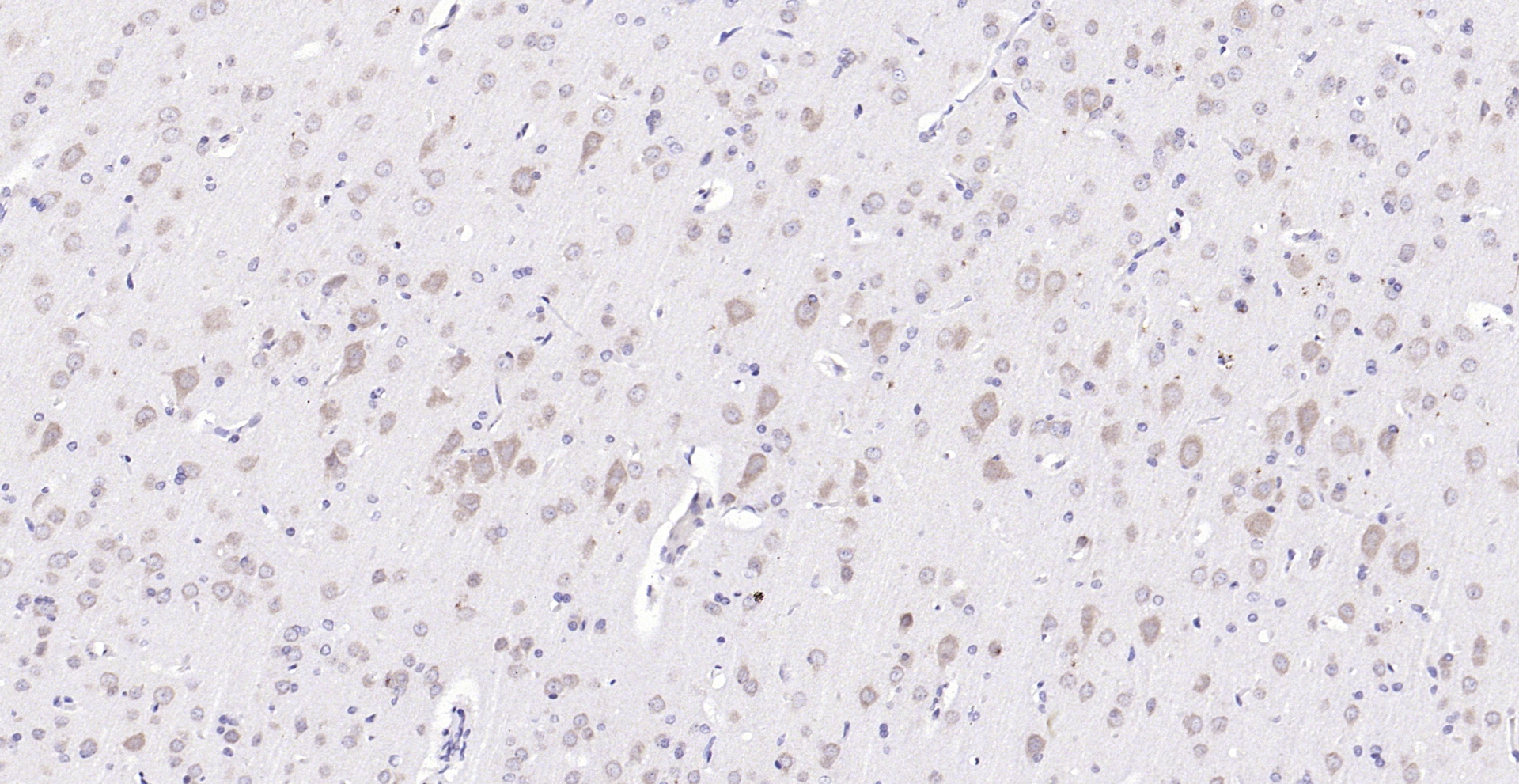 Paraformaldehyde-fixed, paraffin embedded (rat brain); Antigen retrieval by boiling in sodium citrate buffer (pH6.0) for 15min; Block endogenous peroxidase by 3% hydrogen peroxide for 20 minutes; Blocking buffer (normal goat serum) at 37°C for 30min; Antibody incubation with (phospho-FMRP (Ser500)) Polyclonal Antibody, Unconjugated (bs-13188R) at 1:200 overnight at 4°C, followed by operating according to SP Kit(Rabbit) (sp-0023) instructionsand DAB staining.