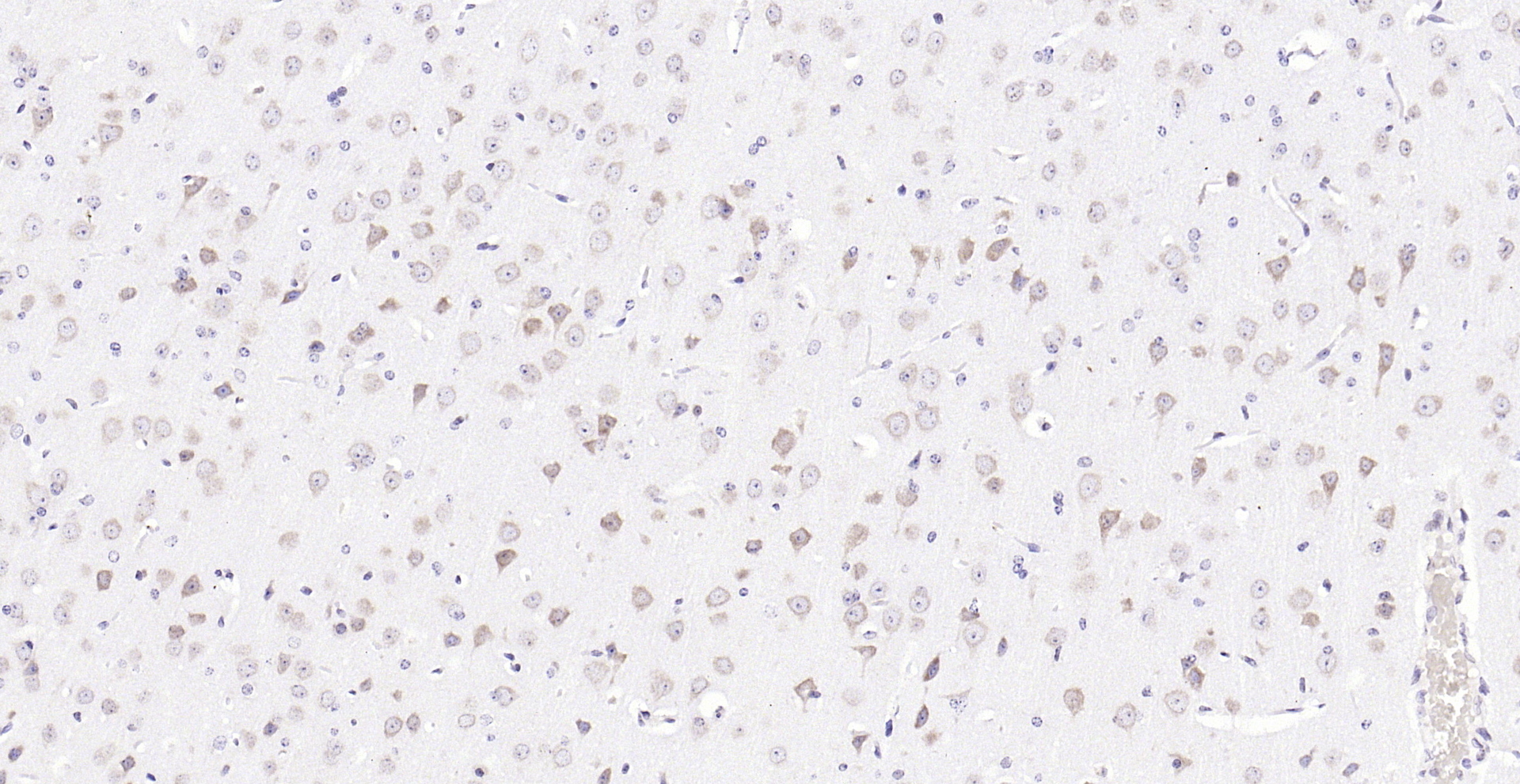 Paraformaldehyde-fixed, paraffin embedded (mouse brain); Antigen retrieval by boiling in sodium citrate buffer (pH6.0) for 15min; Block endogenous peroxidase by 3% hydrogen peroxide for 20 minutes; Blocking buffer (normal goat serum) at 37°C for 30min; Antibody incubation with (phospho-FMRP (Ser500)) Polyclonal Antibody, Unconjugated (bs-13188R) at 1:200 overnight at 4°C, followed by operating according to SP Kit(Rabbit) (sp-0023) instructionsand DAB staining.