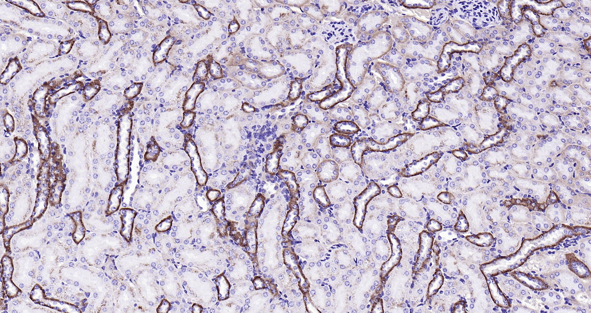 Paraformaldehyde-fixed, paraffin embedded (mouse kidney); Antigen retrieval by boiling in sodium citrate buffer (pH6.0) for 15min; Block endogenous peroxidase by 3% hydrogen peroxide for 20 minutes; Blocking buffer (normal goat serum) at 37°C for 30min; Antibody incubation with (EMP-1) Polyclonal Antibody, Unconjugated (bs-0558R) at 1:200 overnight at 4°C, followed by operating according to SP Kit(Rabbit) (sp-0023) instructionsand DAB staining. Paraformaldehyde-fixed, paraffin embedded (mouse kidney); Antigen retrieval by boiling in sodium citrate buffer (pH6.0) for 15min; Block endogenous peroxidase by 3% hydrogen peroxide for 20 minutes; Blocking buffer (normal goat serum) at 37°C for 30min; Antibody incubation with (EMP-1) Polyclonal Antibody, Unconjugated (bs-0558R) at 1:200 overnight at 4°C, followed by operating according to SP Kit(Rabbit) (sp-0023) instructionsand DAB staining.