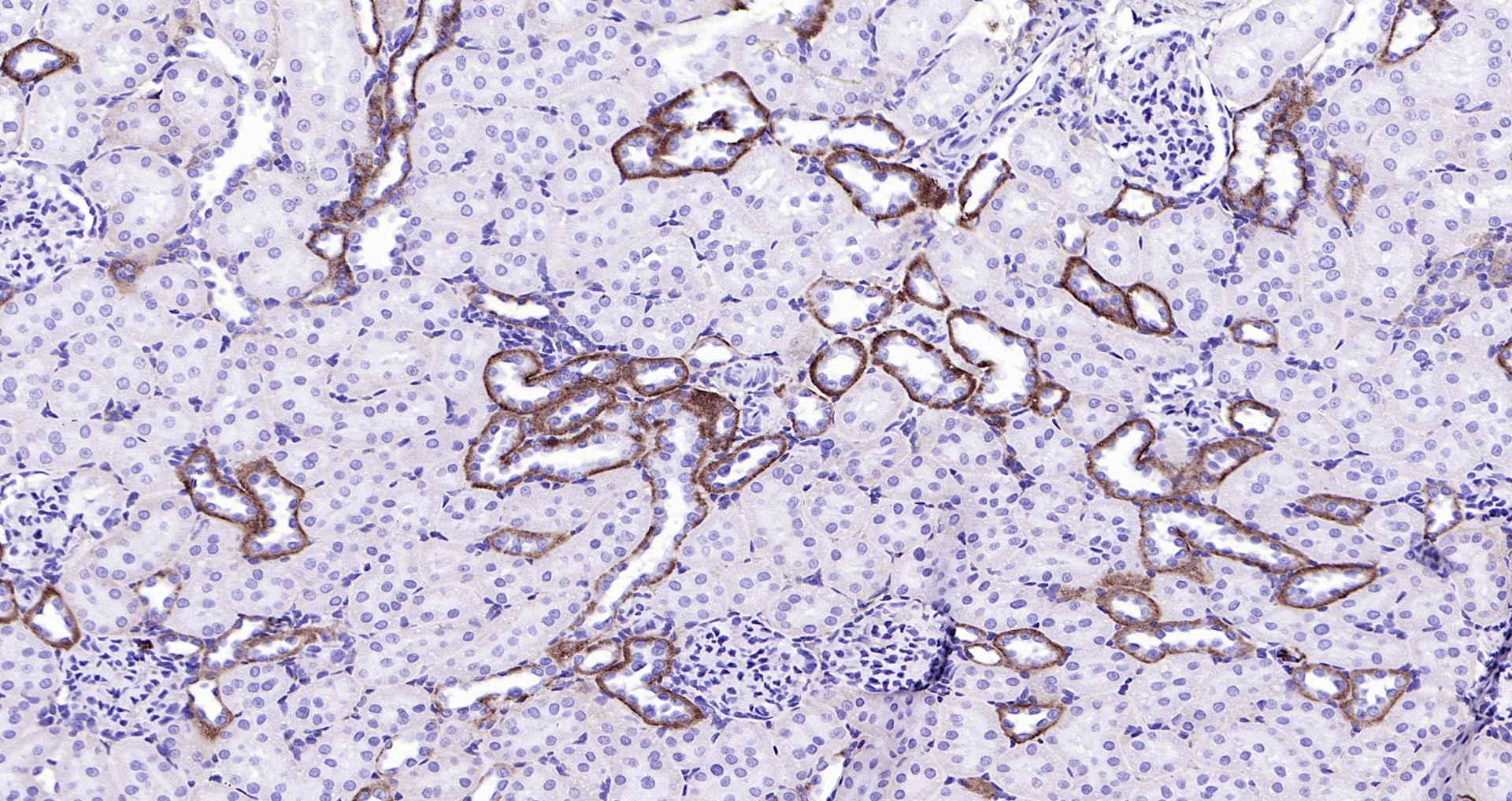Paraformaldehyde-fixed, paraffin embedded (rat kidney); Antigen retrieval by boiling in sodium citrate buffer (pH6.0) for 15min; Block endogenous peroxidase by 3% hydrogen peroxide for 20 minutes; Blocking buffer (normal goat serum) at 37°C for 30min; Antibody incubation with (EMP-1) Polyclonal Antibody, Unconjugated (bs-0558R) at 1:200 overnight at 4°C, followed by operating according to SP Kit(Rabbit) (sp-0023) instructionsand DAB staining. Paraformaldehyde-fixed, paraffin embedded (rat kidney); Antigen retrieval by boiling in sodium citrate buffer (pH6.0) for 15min; Block endogenous peroxidase by 3% hydrogen peroxide for 20 minutes; Blocking buffer (normal goat serum) at 37°C for 30min; Antibody incubation with (EMP-1) Polyclonal Antibody, Unconjugated (bs-0558R) at 1:200 overnight at 4°C, followed by operating according to SP Kit(Rabbit) (sp-0023) instructionsand DAB staining.