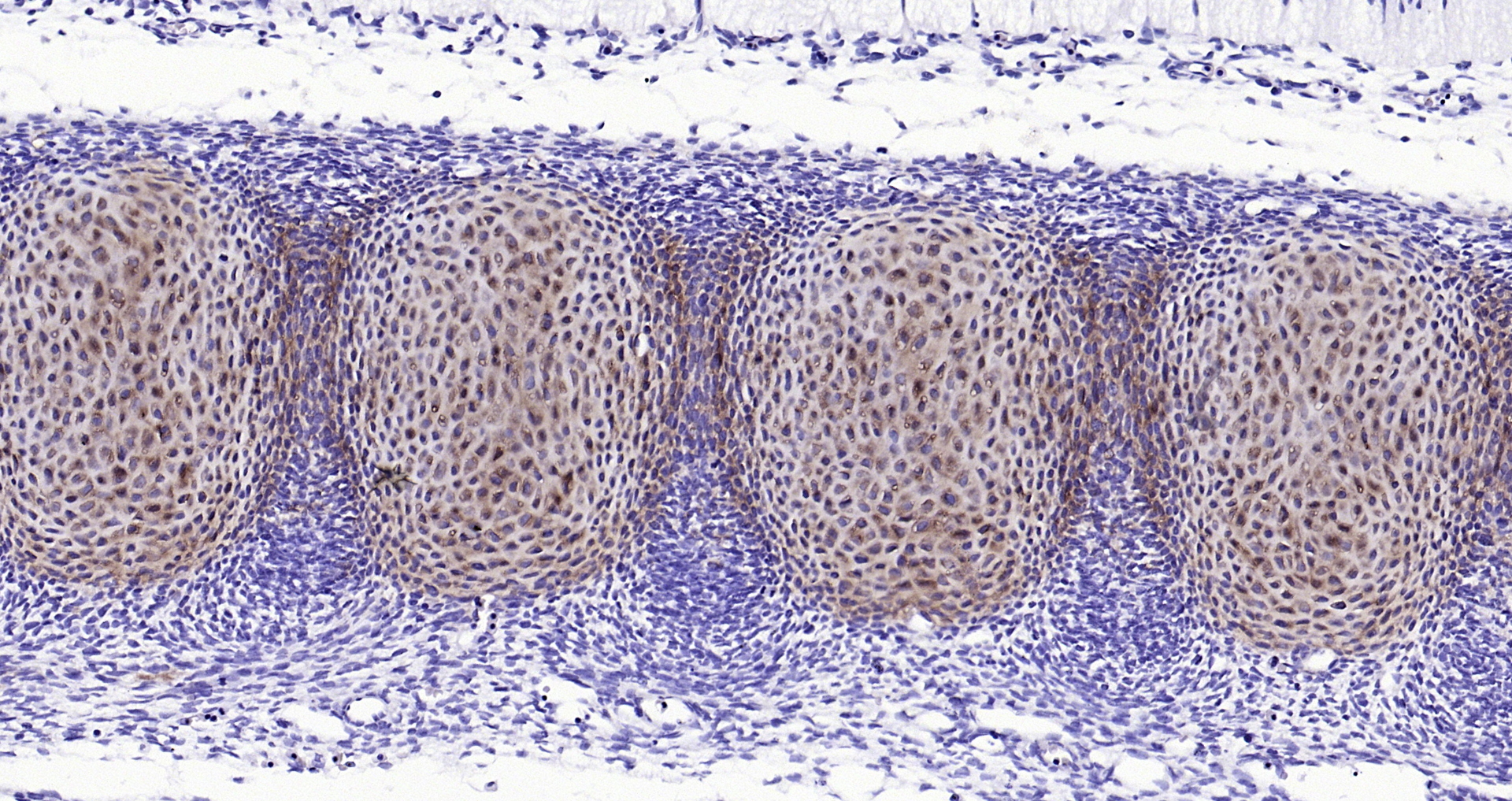 Paraformaldehyde-fixed, paraffin embedded (Rat embryo); Antigen retrieval by boiling in sodium citrate buffer (pH6.0) for 15min; Block endogenous peroxidase by 3% hydrogen peroxide for 20 minutes; Blocking buffer (normal goat serum) at 37°C for 30min; Antibody incubation with (ACAN) Polyclonal Antibody, Unconjugated (bs-11655R) at 1:200 overnight at 4°C, followed by operating according to SP Kit(Rabbit) (sp-0023) instructionsand DAB staining.