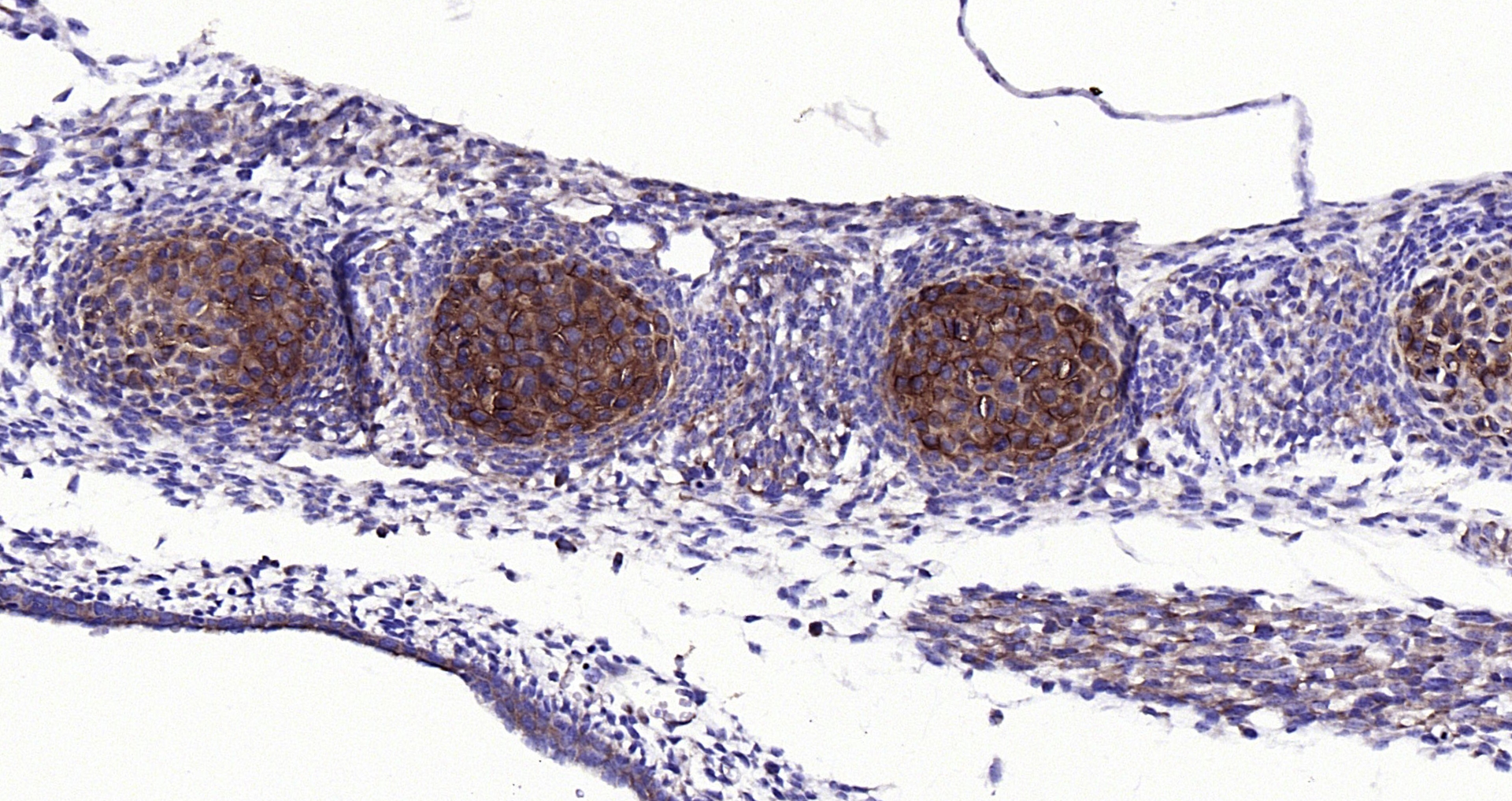 Paraformaldehyde-fixed, paraffin embedded (mouse embryo); Antigen retrieval by boiling in sodium citrate buffer (pH6.0) for 15min; Block endogenous peroxidase by 3% hydrogen peroxide for 20 minutes; Blocking buffer (normal goat serum) at 37°C for 30min; Antibody incubation with (ACAN) Polyclonal Antibody, Unconjugated (bs-11655R) at 1:200 overnight at 4°C, followed by operating according to SP Kit(Rabbit) (sp-0023) instructionsand DAB staining.