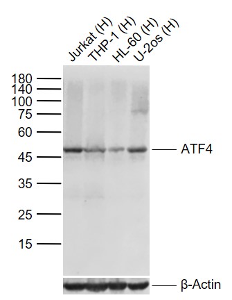 Lane 1: Human Jurkat cell lysates; Lane 2: Human THP-1 cell lysates; Lane 3: Human HL-60 cell lysates; Lane 4: Human U2os cell lysates probed with ATF4 Monoclonal Antibody, Unconjugated (bsm-52667R) at 1:1000 dilution and 4°C overnight incubation. Followed by conjugated secondary antibody incubation at 1:20000 for 60 min at 37˚C.