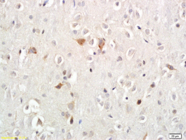 Formalin-fixed and paraffin embedded rat brain labeled with Anti-Persephin Polyoclonal Antibody, Unconjugated (bs-1518R) followed by conjugation to the secondary antibody and DAB staining