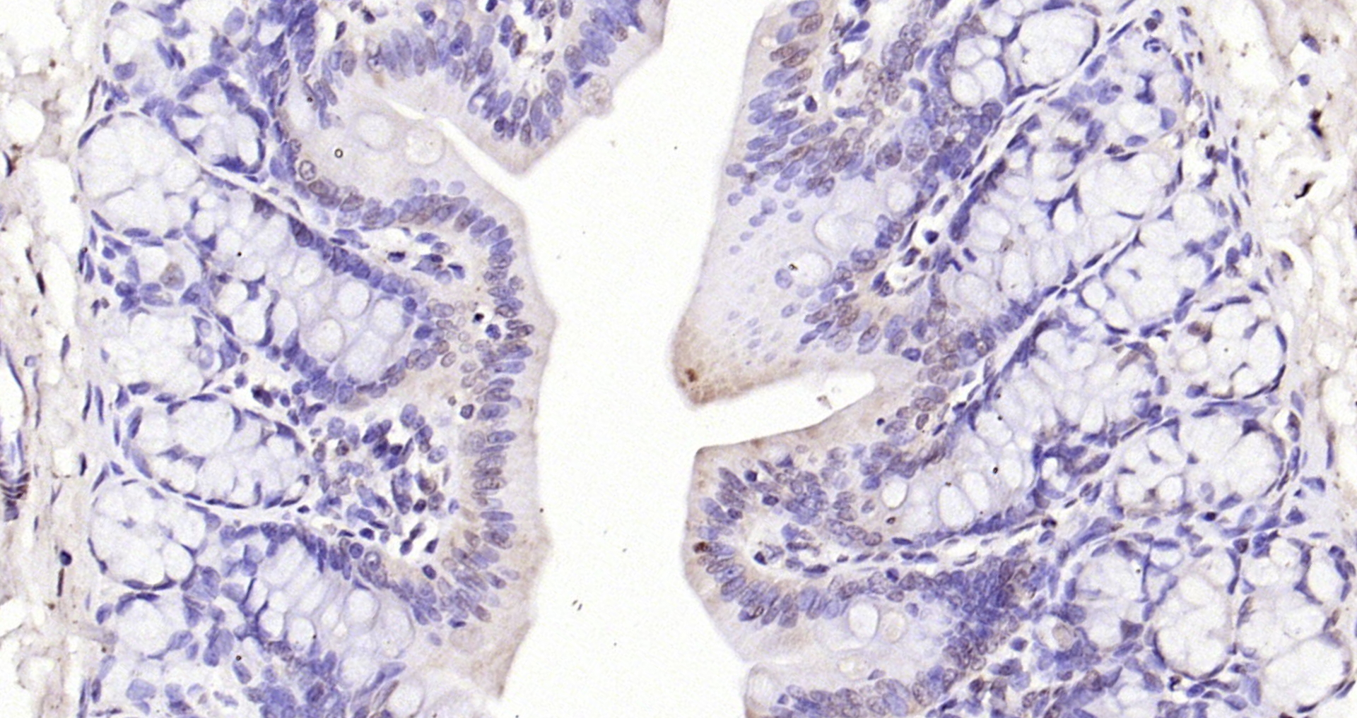 Paraformaldehyde-fixed, paraffin embedded (rat colon); Antigen retrieval by boiling in sodium citrate buffer (pH6.0) for 15min; Block endogenous peroxidase by 3% hydrogen peroxide for 20 minutes; Blocking buffer (normal goat serum) at 37°C for 30min; Antibody incubation with (phospho-p107 (Ser975)) Polyclonal Antibody, Unconjugated (bs-5696R) at 1:200 overnight at 4°C, followed by operating according to SP Kit(Rabbit) (sp-0023) instructionsand DAB staining.