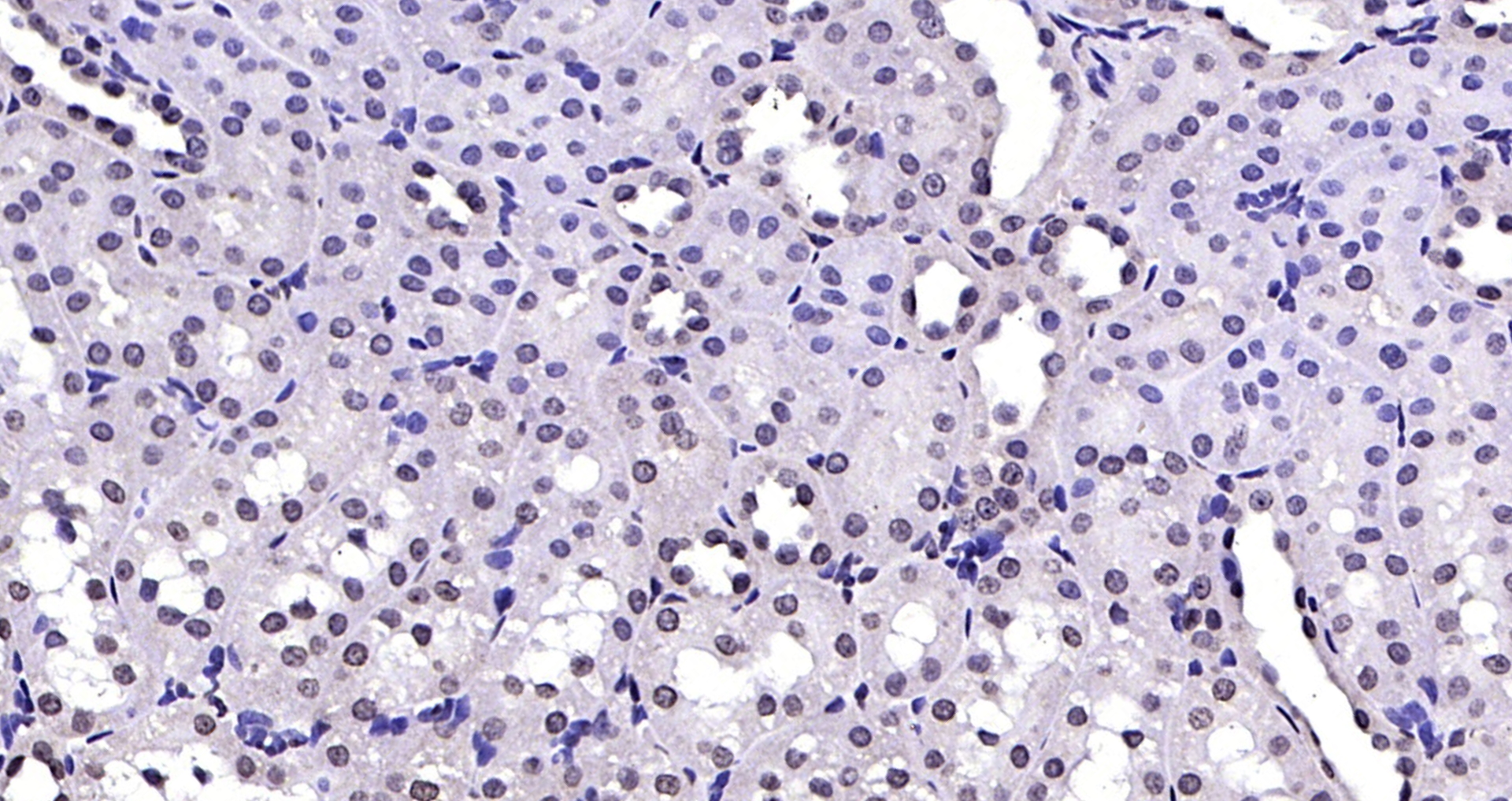 Paraformaldehyde-fixed, paraffin embedded (Rat kidney); Antigen retrieval by boiling in sodium citrate buffer (pH6.0) for 15min; Block endogenous peroxidase by 3% hydrogen peroxide for 20 minutes; Blocking buffer (normal goat serum) at 37°C for 30min; Antibody incubation with (NPD014) Polyclonal Antibody, Unconjugated (bs-6441R) at 1:200 overnight at 4°C, followed by operating according to SP Kit(Rabbit) (sp-0023) instructionsand DAB staining.