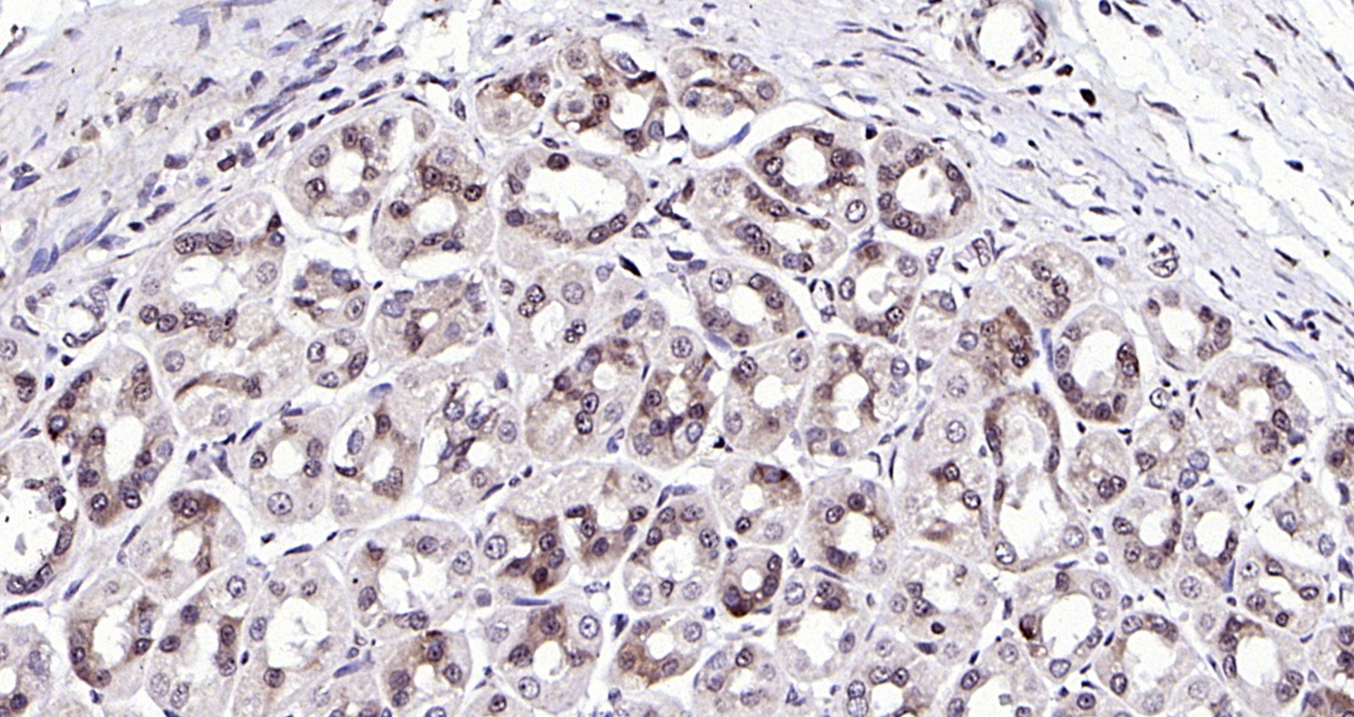 Paraformaldehyde-fixed, paraffin embedded (Rat stomach); Antigen retrieval by boiling in sodium citrate buffer (pH6.0) for 15min; Block endogenous peroxidase by 3% hydrogen peroxide for 20 minutes; Blocking buffer (normal goat serum) at 37°C for 30min; Antibody incubation with (NPD014) Polyclonal Antibody, Unconjugated (bs-6441R) at 1:200 overnight at 4°C, followed by operating according to SP Kit(Rabbit) (sp-0023) instructionsand DAB staining.