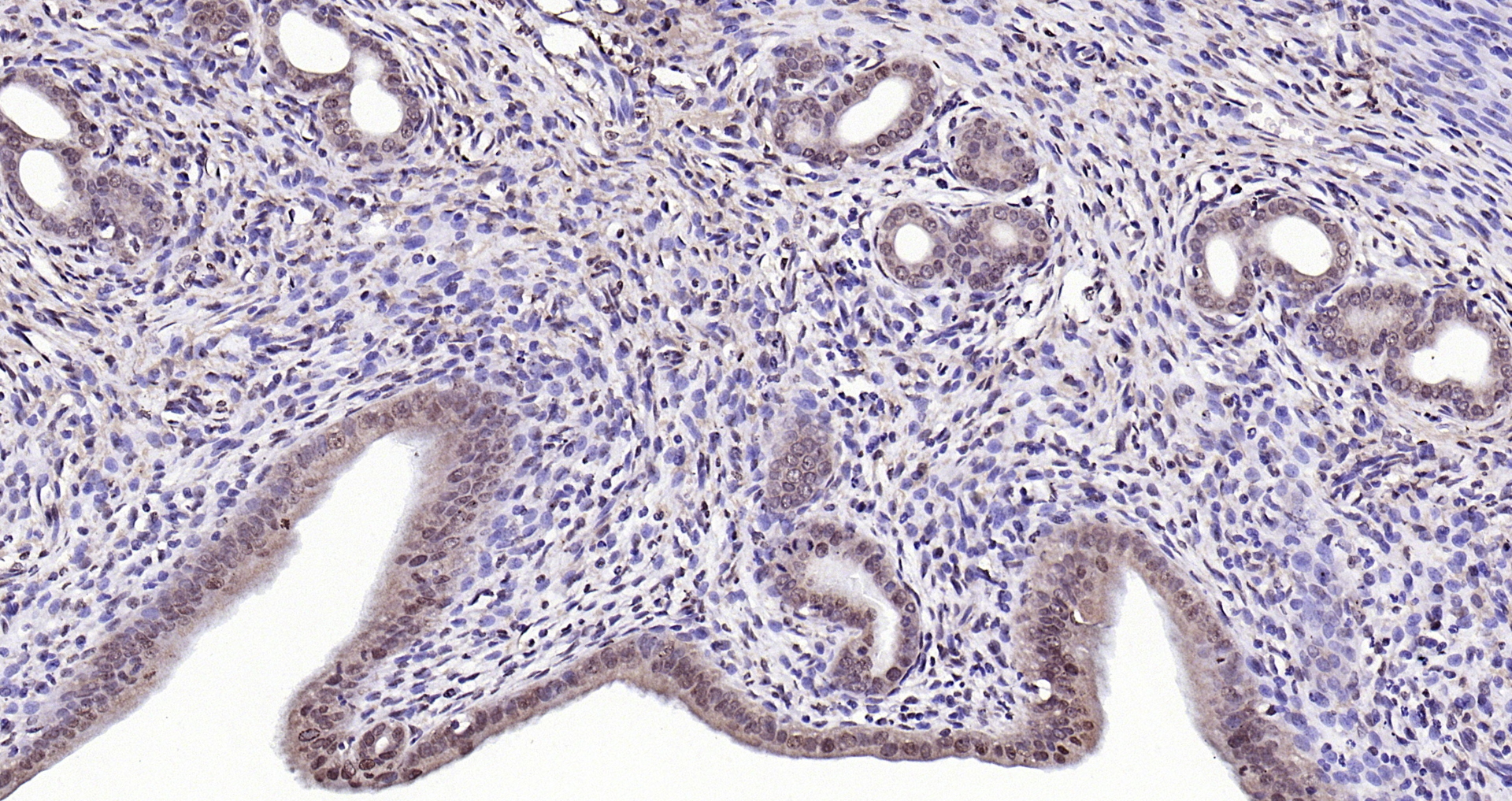 Paraformaldehyde-fixed, paraffin embedded ( Rat uterus); Antigen retrieval by boiling in sodium citrate buffer (pH6.0) for 15min; Block endogenous peroxidase by 3% hydrogen peroxide for 20 minutes; Blocking buffer (normal goat serum) at 37°C for 30min; Antibody incubation with (NPD014) Polyclonal Antibody, Unconjugated (bs-6441R) at 1:200 overnight at 4°C, followed by operating according to SP Kit(Rabbit) (sp-0023) instructionsand DAB staining.