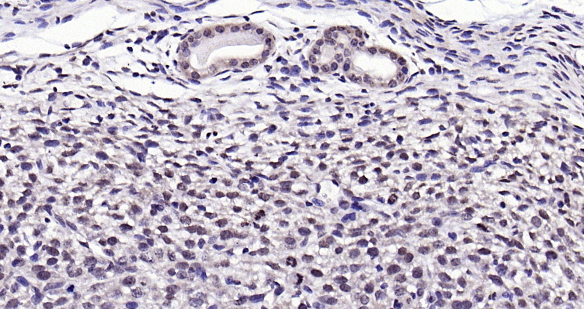 Paraformaldehyde-fixed, paraffin embedded ( mouse uterus); Antigen retrieval by boiling in sodium citrate buffer (pH6.0) for 15min; Block endogenous peroxidase by 3% hydrogen peroxide for 20 minutes; Blocking buffer (normal goat serum) at 37°C for 30min; Antibody incubation with (NPD014) Polyclonal Antibody, Unconjugated (bs-6441R) at 1:200 overnight at 4°C, followed by operating according to SP Kit(Rabbit) (sp-0023) instructionsand DAB staining.