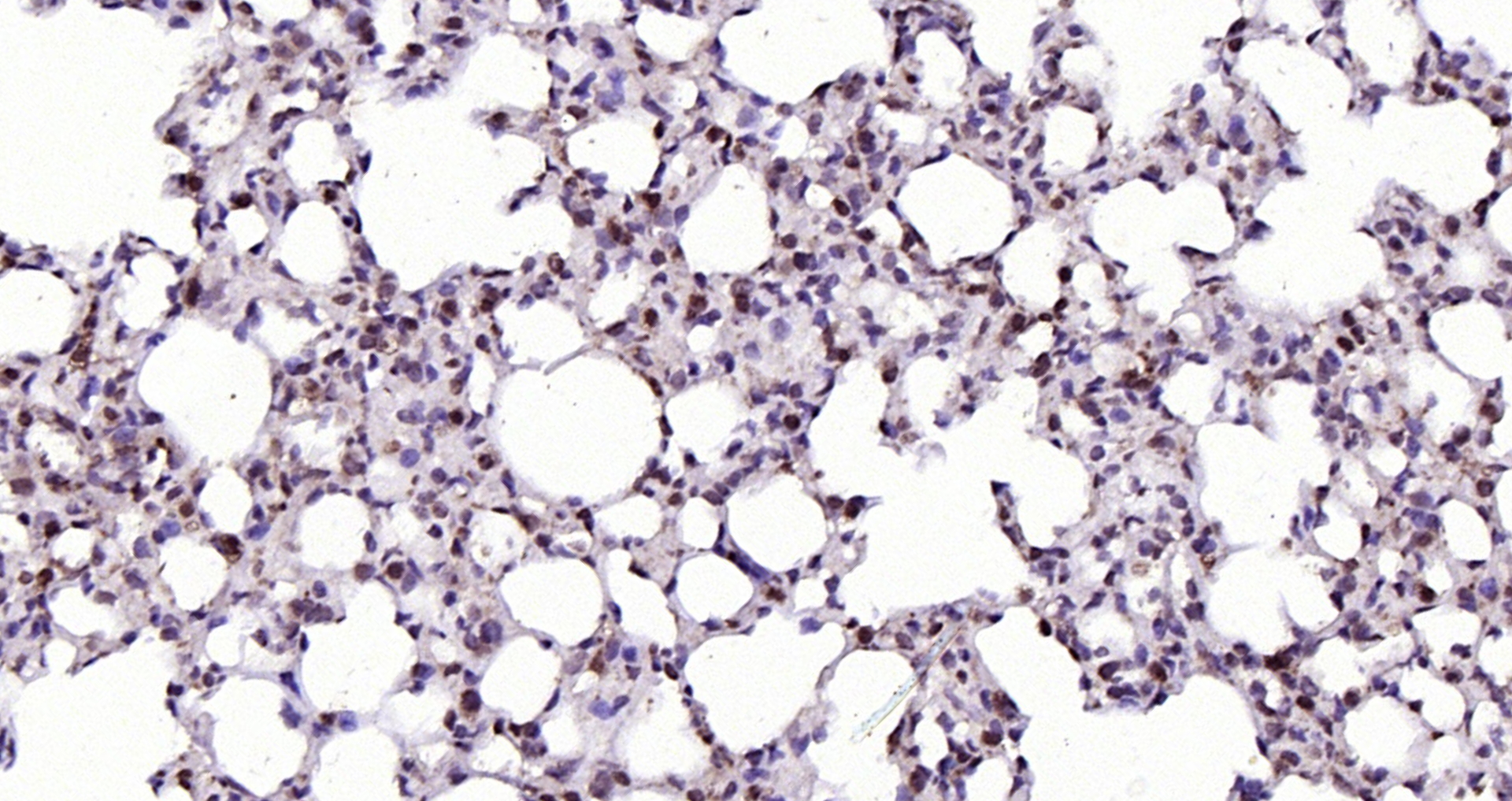 Paraformaldehyde-fixed, paraffin embedded (rat lung); Antigen retrieval by boiling in sodium citrate buffer (pH6.0) for 15min; Block endogenous peroxidase by 3% hydrogen peroxide for 20 minutes; Blocking buffer (normal goat serum) at 37°C for 30min; Antibody incubation with (RGC32) Polyclonal Antibody, Unconjugated (bs-9079R) at 1:200 overnight at 4°C, followed by operating according to SP Kit(Rabbit) (sp-0023) instructionsand DAB staining.