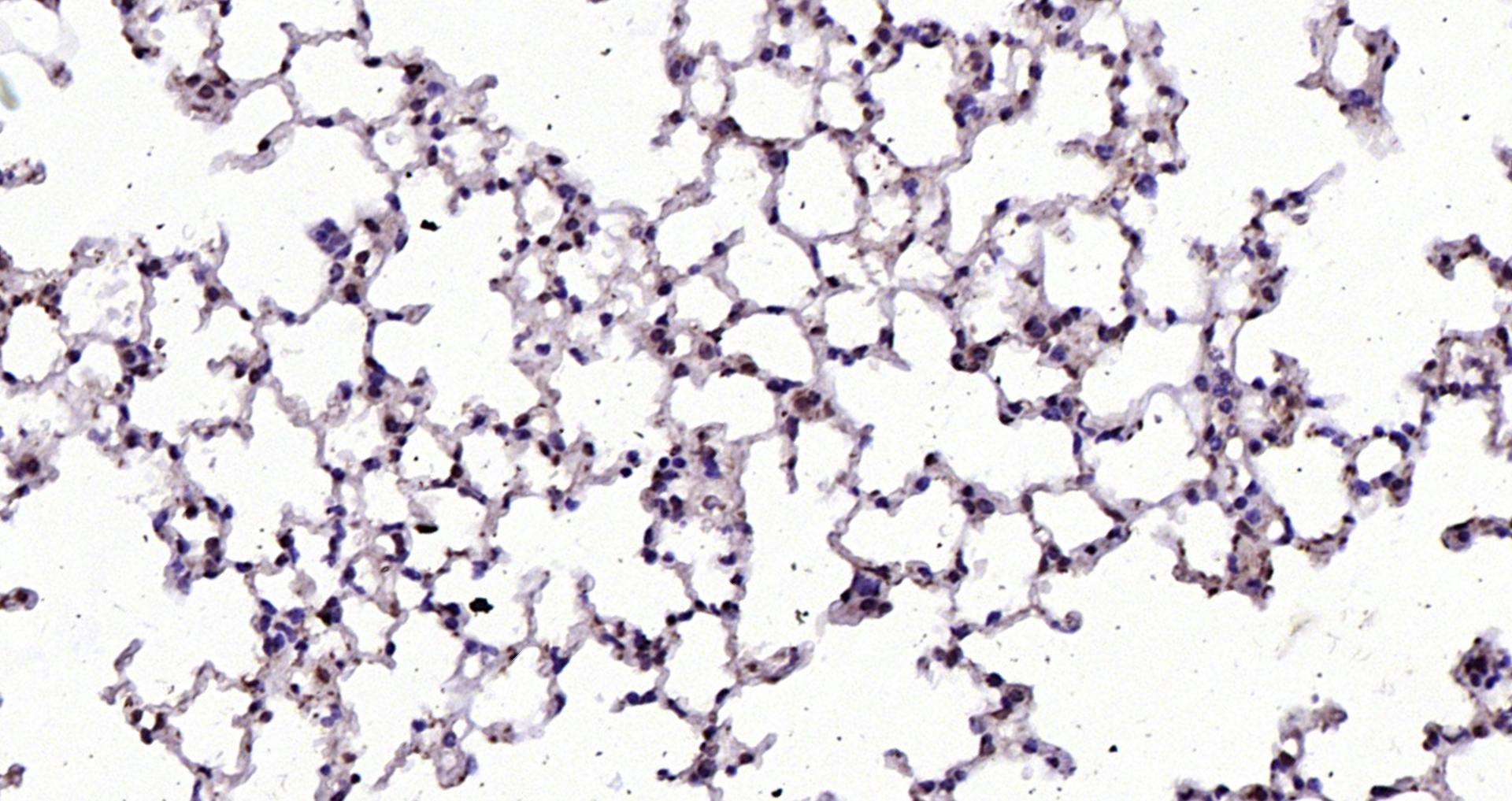 Paraformaldehyde-fixed, paraffin embedded (mouse lung); Antigen retrieval by boiling in sodium citrate buffer (pH6.0) for 15min; Block endogenous peroxidase by 3% hydrogen peroxide for 20 minutes; Blocking buffer (normal goat serum) at 37°C for 30min; Antibody incubation with (RGC32) Polyclonal Antibody, Unconjugated (bs-9079R) at 1:200 overnight at 4°C, followed by operating according to SP Kit(Rabbit) (sp-0023) instructionsand DAB staining.