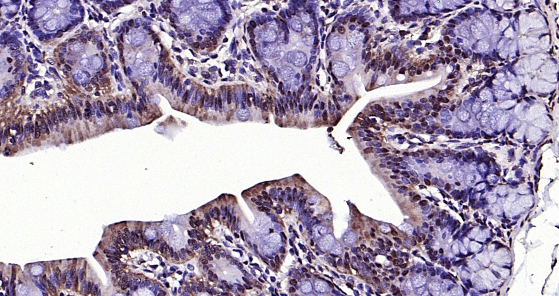 Paraformaldehyde-fixed, paraffin embedded (rat colon); Antigen retrieval by boiling in sodium citrate buffer (pH6.0) for 15min; Block endogenous peroxidase by 3% hydrogen peroxide for 20 minutes; Blocking buffer (normal goat serum) at 37°C for 30min; Antibody incubation with (RGC32) Polyclonal Antibody, Unconjugated (bs-9079R) at 1:200 overnight at 4°C, followed by operating according to SP Kit(Rabbit) (sp-0023) instructionsand DAB staining.