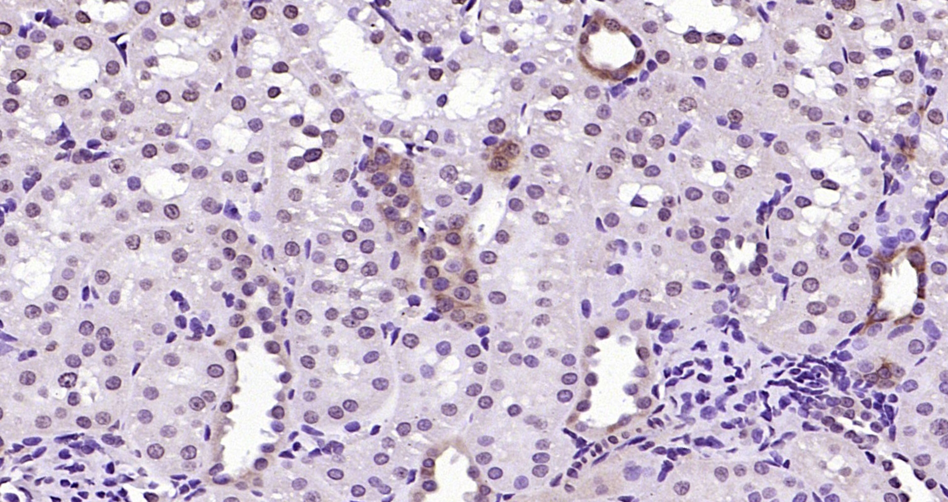 Paraformaldehyde-fixed, paraffin embedded (rat kidney); Antigen retrieval by boiling in sodium citrate buffer (pH6.0) for 15min; Block endogenous peroxidase by 3% hydrogen peroxide for 20 minutes; Blocking buffer (normal goat serum) at 37°C for 30min; Antibody incubation with (RGC32) Polyclonal Antibody, Unconjugated (bs-9079R) at 1:200 overnight at 4°C, followed by operating according to SP Kit(Rabbit) (sp-0023) instructionsand DAB staining.
