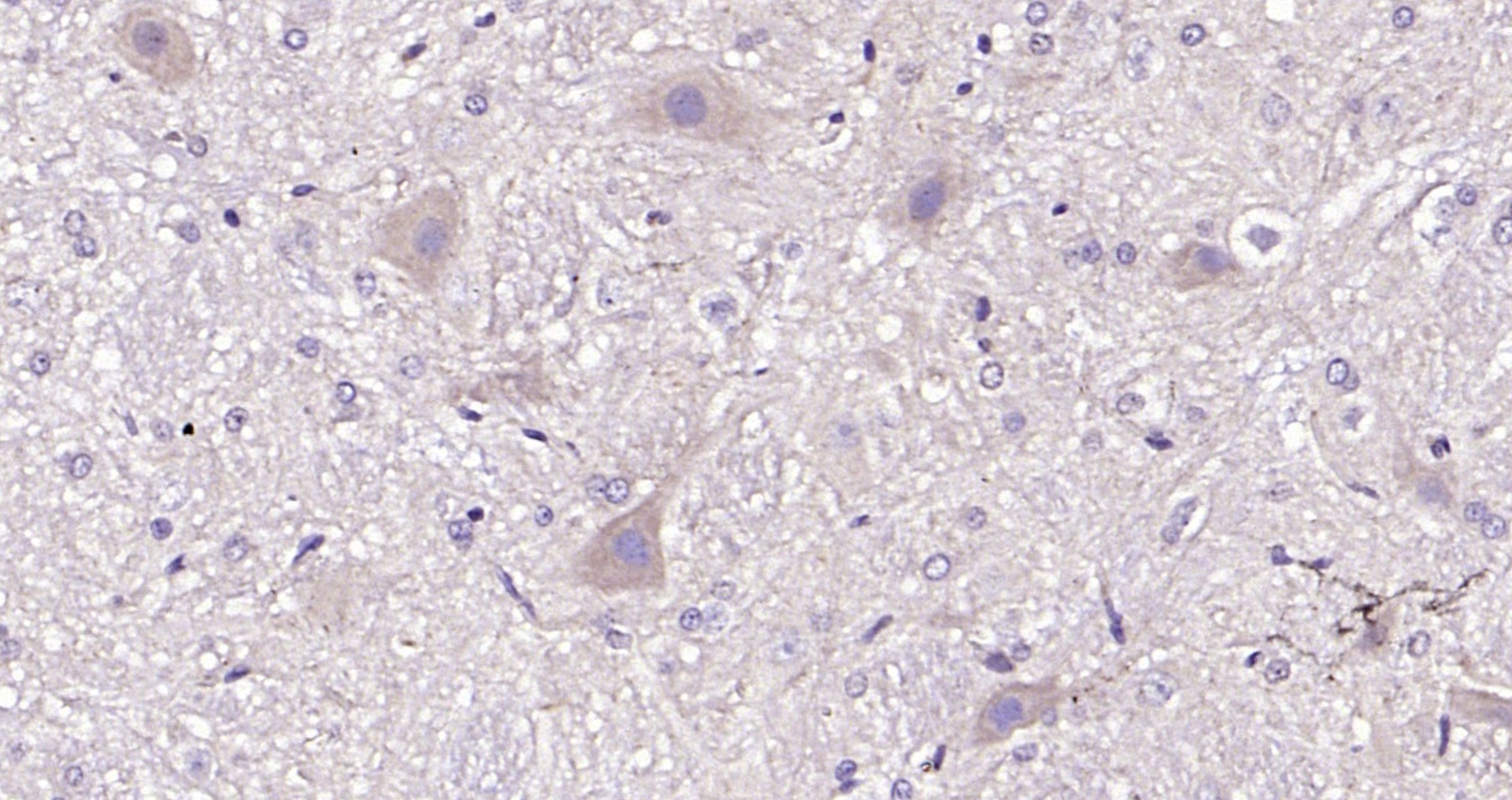 Paraformaldehyde-fixed, paraffin embedded (mouse cerebellum); Antigen retrieval by boiling in sodium citrate buffer (pH6.0) for 15min; Block endogenous peroxidase by 3% hydrogen peroxide for 20 minutes; Blocking buffer (normal goat serum) at 37°C for 30min; Antibody incubation with (SV2B) Polyclonal Antibody, Unconjugated (bs-11113R) at 1:200 overnight at 4°C, followed by operating according to SP Kit(Rabbit) (sp-0023) instructionsand DAB staining.