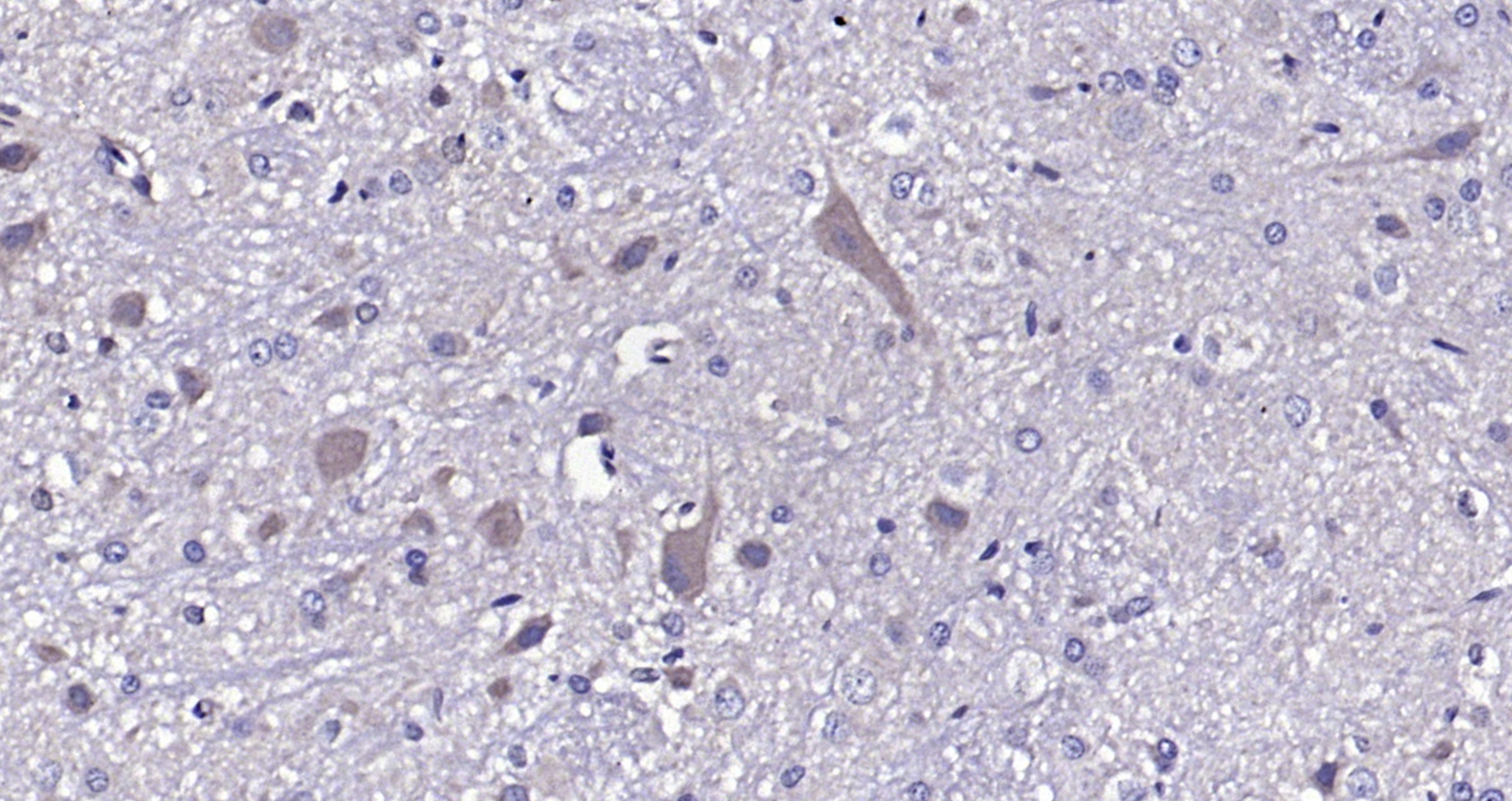 Paraformaldehyde-fixed, paraffin embedded (rat cerebellum); Antigen retrieval by boiling in sodium citrate buffer (pH6.0) for 15min; Block endogenous peroxidase by 3% hydrogen peroxide for 20 minutes; Blocking buffer (normal goat serum) at 37°C for 30min; Antibody incubation with (SV2B) Polyclonal Antibody, Unconjugated (bs-11365R) at 1:200 overnight at 4°C, followed by operating according to SP Kit(Rabbit) (sp-0023) instructionsand DAB staining. Paraformaldehyde-fixed, paraffin embedded (rat cerebellum); Antigen retrieval by boiling in sodium citrate buffer (pH6.0) for 15min; Block endogenous peroxidase by 3% hydrogen peroxide for 20 minutes; Blocking buffer (normal goat serum) at 37°C for 30min; Antibody incubation with (SV2B) Polyclonal Antibody, Unconjugated (bs-11365R) at 1:200 overnight at 4°C, followed by operating according to SP Kit(Rabbit) (sp-0023) instructionsand DAB staining.