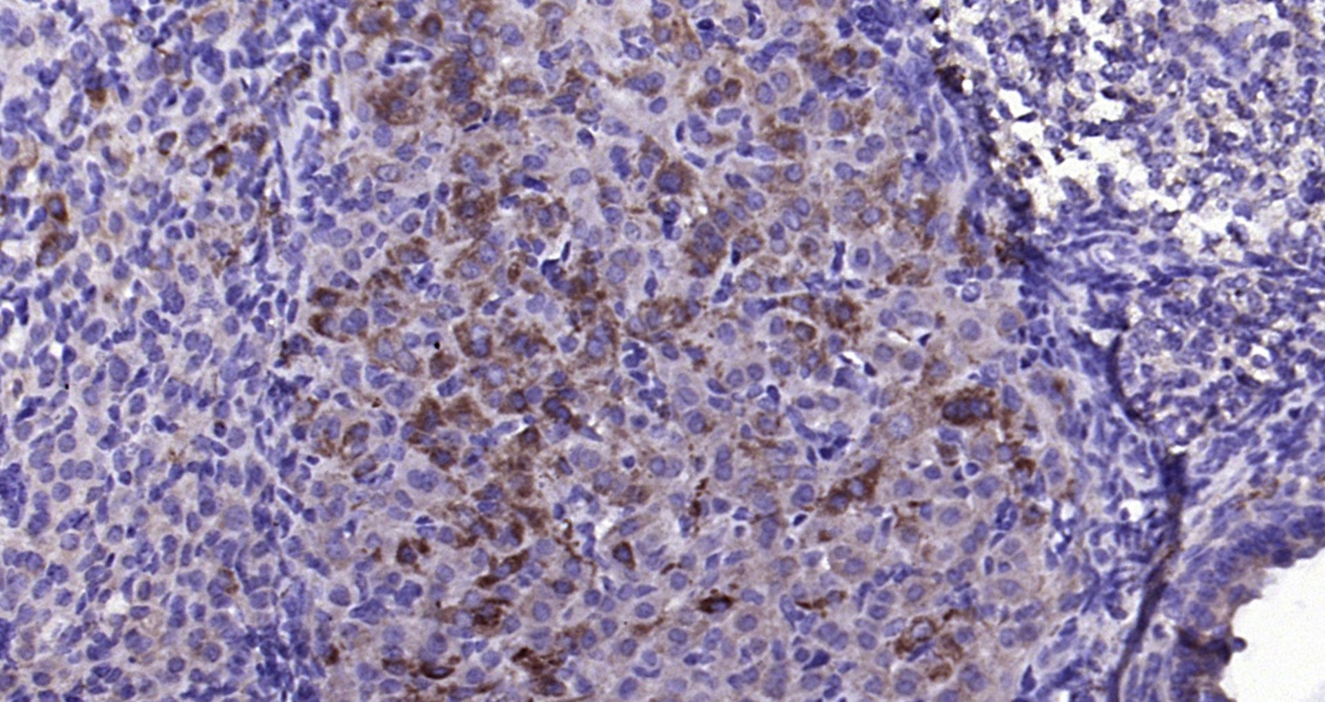 Paraformaldehyde-fixed, paraffin embedded (mouse ovary); Antigen retrieval by boiling in sodium citrate buffer (pH6.0) for 15min; Block endogenous peroxidase by 3% hydrogen peroxide for 20 minutes; Blocking buffer (normal goat serum) at 37°C for 30min; Antibody incubation with (FGF8) Polyclonal Antibody, Unconjugated (bs-0735R) at 1:200 overnight at 4°C, followed by operating according to SP Kit(Rabbit) (sp-0023) instructionsand DAB staining.