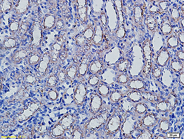 Formalin-fixed and paraffin embedded rat kidney labeled with Anti-AQP5 Polyclonal Antibody, Unconjugated (bs-1554R) followed by conjugation to the secondary antibody and DAB staining