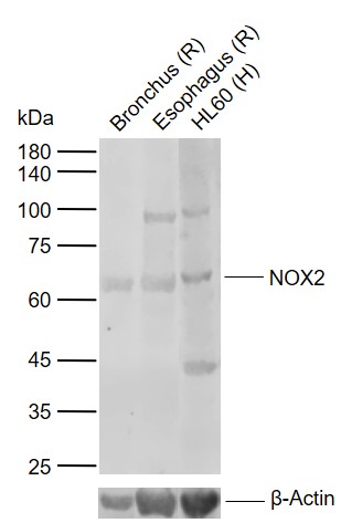 Lane 1: Rat Bronchus tissue lysates; Lane 2: Rat Esophagus tissue lysates; Lane 3: Human HL60 cell lysates probed with NOX2 Polyclonal Antibody, Unconjugated (bs-3889R) at 1:1000 dilution and 4°C overnight incubation. Followed by conjugated secondary antibody incubation at 1:20000 for 60 min at 37˚C.
