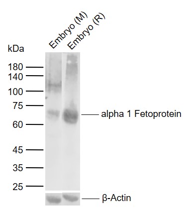 Lane 1: Mouse Embryo tissue lysates; Lane 2: Rat Embryo tissue lysates probed with alpha 1 Fetoprotein Polyclonal Antibody, Unconjugated (bs-8616R) at 1:1000 dilution and 4°C overnight incubation. Followed by conjugated secondary antibody incubation at 1:20000 for 60 min at 37˚C.