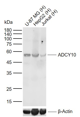 Lane 1: Human U-87 MG cell lysates; Lane 2: Human HepG2 cell lysates; Lane 3: Human Jurkat cell lysates probed with ADCY10 Polyclonal Antibody, Unconjugated (bs-3916R) at 1:1000 dilution and 4°C overnight incubation. Followed by conjugated secondary antibody incubation at 1:20000 for 60 min at 37˚C.