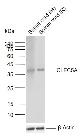 Lane 1: Mouse Spinal cord tissue lysates; Lane 2: Rat Spinal cord tissue lysates probed with CLEC5A Polyclonal Antibody, Unconjugated (bs-2663R) at 1:1000 dilution and 4°C overnight incubation. Followed by conjugated secondary antibody incubation at 1:20000 for 60 min at 37˚C.