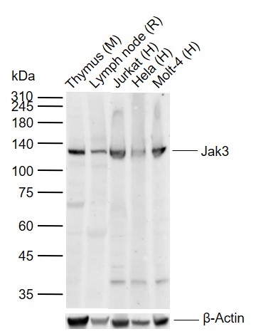 Lane 1: Mouse Thymus tissue lysates; Lane 2: Rat Lymph node tissue lysates; Lane 3: Human Jurkat cell lysates; Lane 4: Human Hela cell lysates; Lane 5: Human Molt-4 cell lysates probed with Jak3 Polyclonal Antibody, Unconjugated (bs-2808R) at 1:1000 dilution and 4°C overnight incubation. Followed by conjugated secondary antibody incubation at 1:20000 for 60 min at 37˚C. Lane 1: Mouse Thymus tissue lysates; Lane 2: Rat Lymph node tissue lysates; Lane 3: Human Jurkat cell lysates; Lane 4: Human Hela cell lysates; Lane 5: Human Molt-4 cell lysates probed with Jak3 Polyclonal Antibody, Unconjugated (bs-2808R) at 1:1000 dilution and 4°C overnight incubation. Followed by conjugated secondary antibody incubation at 1:20000 for 60 min at 37˚C.