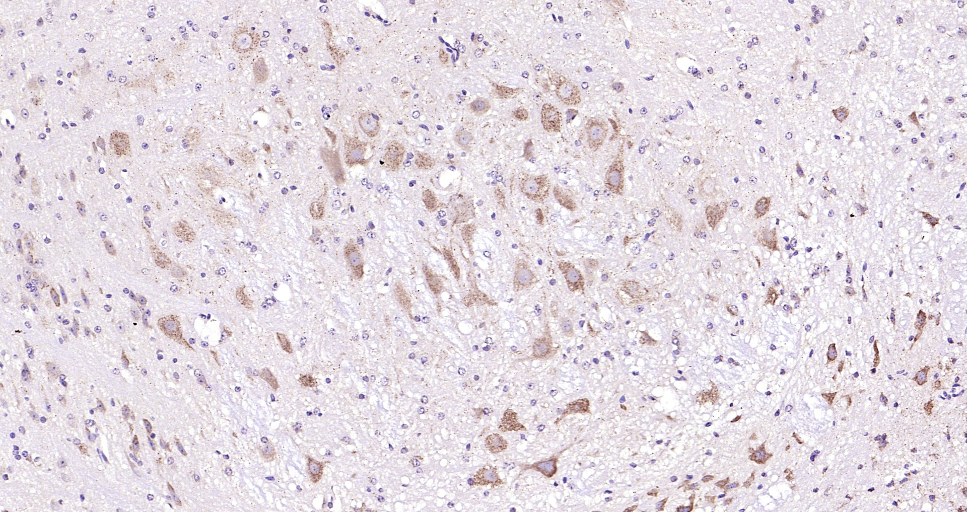 Paraformaldehyde-fixed, paraffin embedded (Mouse cerebellum); Antigen retrieval by boiling in sodium citrate buffer (pH6.0) for 15min; Block endogenous peroxidase by 3% hydrogen peroxide for 20 minutes; Blocking buffer (normal goat serum) at 37°C for 30min; Antibody incubation with (MTNR1B) Polyclonal Antibody, Unconjugated (bs-0963R) at 1:200 overnight at 4°C, followed by operating according to SP Kit(Rabbit) (sp-0023) instructionsand DAB staining.